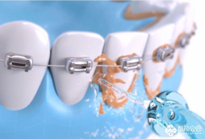 其实你知道的，刷牙并不能彻底的清洁牙齿 智能公会